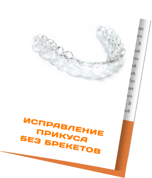 Исправление прикуса без брекетов