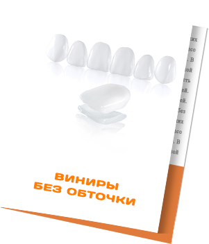 Виниры без обточки